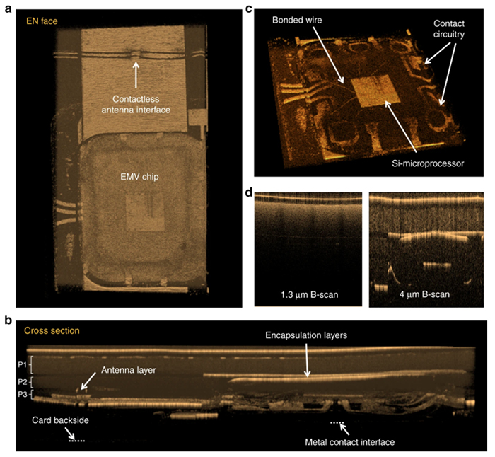 光学相干断层扫描 光学相干断层扫描